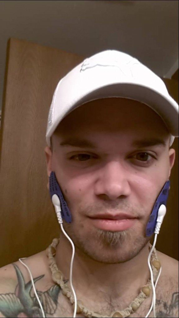 Elektroden op het gezicht