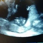 Foetus heeft al ritmegevoel