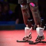 Nieuwe technologie bionische ledematen