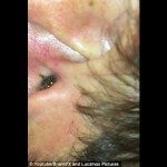 Verrassing in een oor