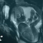 Zo ziet seks er aan de binnenkant uit