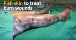 De huid van tilapia tegen brandwonden