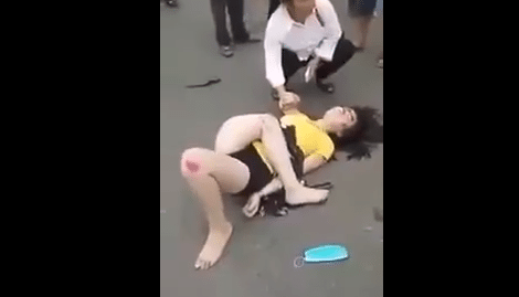 AUW! Kijk naar dat been van de vrouw