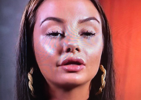 Bizar: Botox-meisje bij First Dates